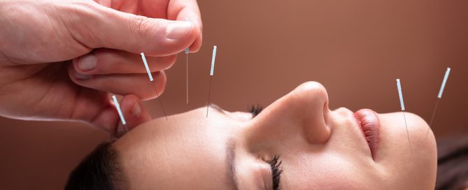 Cranial facial needling physiotherapist in Elwood